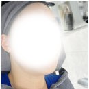 [광주피부관리] 피앤피뷰티연구소 좁쌀 염증 트러블 자국 상담 홈케어 후기