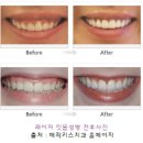 미소라인 이미지