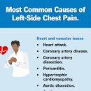 왼쪽 심장 찌릿 가슴 찌릿 통증 가슴밑찌릿 정리 이미지