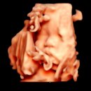 35-D | 임신 후기 증상 35주 임산부 D-30 고난주간 보내는중