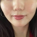 더 페이즈 | 사르티네의원 쿨페이즈 효과,가격, 통증 후기