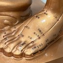 아름나무한의원 | 엠테스트 007. 갑작스런 발가락 통증