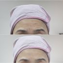 예인피부관리 이미지
