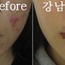 리유한의원 네이버블로그