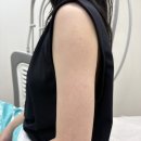 (주)비버글로벌 서울지점 | 내돈내산 온다리프팅/바디온다/팔뚝온다 후기 [명동-카인드글로벌의원/스레드 핫한 그 병원맞음]