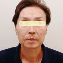 브라이튼피부과의원 이미지