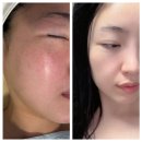 오광케어 | 서창동 피부관리 [박선화 스킨케어] 극건성 추천 오광필 트리트먼트 얼굴 관리 물광피부 후기