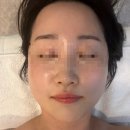 세븐일레븐구미임은타운점 | 구미 루미에스테틱 피부 관리샵 수기 관리 물광리프팅케어 후기