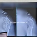 리햅포먼스 이미지