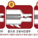 레꼴뜨 이미지