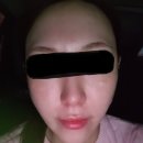 메이퓨어의원마포공덕점 | [메이퓨어_수내점] 내돈내산!! 분당피부과 추천!!!! #보톡스#필러#레이져시술