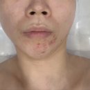 진천동피부관리 꽃피우는여자, 대구여드름압출 장인의 손길로 깐달걀 피부 완성!