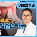최승효이비인후과의원 비온뒤