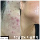 발라또 | 발라또 935 사용 후기