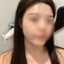 델루나뷰티 | 풍무동 피부관리 델루나뷰티에서 LDM물방울 관리 받은 후기
