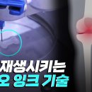 인체에 무해한 인공장기 인쇄 '3D 바이오 잉크' 첫 개발 이미지