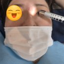 영광한의원 | 부산흉터제거 여드름흉터한의원에서 30년된 오래된흉터 새살침 치료 6회차 후기 깊은흉터 살이 다 올라...