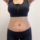 대전 비만클리닉 하프한 바디라인 만든 지방분해주사 시술종료 후기(-12kg 감량)