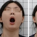 핏한의원 네이버블로그