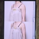 김해웨딩관리 찾는다면 팔뚝라인 확 달라진 수에스테틱 후기