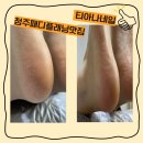 WG아트 | 청주패디플래닝 티아나네일 – 자극 없이 완벽한 발각질 제거!