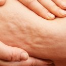 슬림영의원 이미지