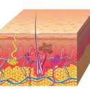 모공각화증이란? 이미지