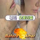 미래엘 | [강원/ 춘천] 뷰티오로라엘 본점 왁싱 후기
