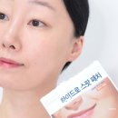 노스팟 | 티 안 나는 여드름패치 추천! 가성비 노브랜드 스팟패치 피부 트러블 진정 후기