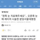 “왼쪽 눈 치료해주세요”… 오른쪽 눈에 레이저 시술한 분당서울대병원 이미지