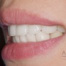 에이블덴탈 이미지