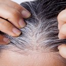 모나라피부과의원 이미지