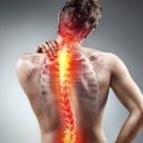 마곡베스트정형외과의원 | 공항시장역 정형외과 목이 뻣뻣하고 팔까지 저리다면? 목디스크일까요?