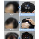 모담의원 네이버블로그