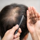 L.G메디 | 스피모나 탈모 앰플이 주목받는 이유, 3050 남성 탈모의 모든 것