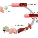 패혈증 뜻 진단 발병 원인 증상 치료 이미지