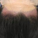 부산 맘모스헤어라인의원 이미지