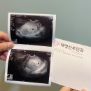 화성 남양읍 혜영산부인과 방문 후기 (임신확인증 발급!)