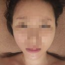 5383 | 광주 화정동 윤곽관리 잘하는 곳 리큐브에스테틱 1월 윤곽관리 이벤트 윤곽스타터 후기