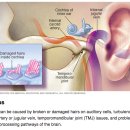 Re:Re: Prevention and Restoration of Hearing Loss Associated with the Use of Cisplatin 이미지