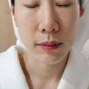 오목교역 피부관리실 엘피지오 목동점 써마웨이브 관리 후기