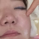 채담빛피부관리 네이버블로그