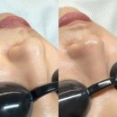 엔피산 | 서울 노원 공릉동 에스테틱 피부 관리실 ' 엔피 에스테틱 ' 방문 후기