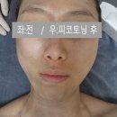 군산 피부관리 보금뷰티 토닝 리프팅 올인원 관리