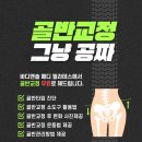 골반교정 필라테스 이미지