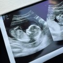 왕무체육관(태권도) | [임신일기] 9주~16주(일산 허유재병원, 니프티후기)