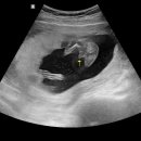 삼성미래여성병원 이미지