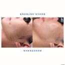 빛채은에스테틱 대구진천점