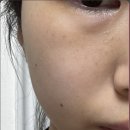 보성유지바이오㈜ | 바이오힐 보 3D 리프팅 피부 탄력크림 4주 사용 효과 후기