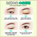 미호성형외과의원 이미지